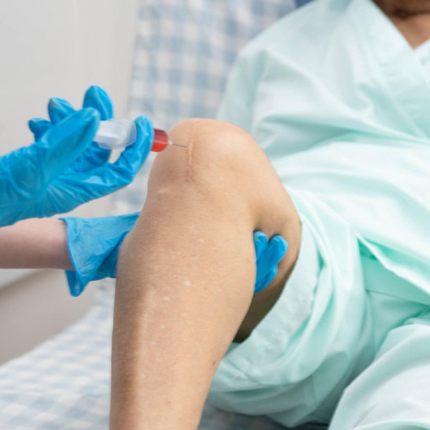 ACL Reconstruction