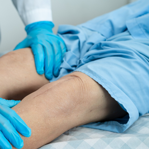 ACL Reconstruction treatment