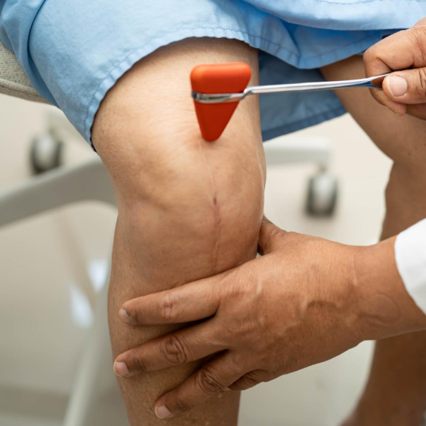ACL Reconstruction