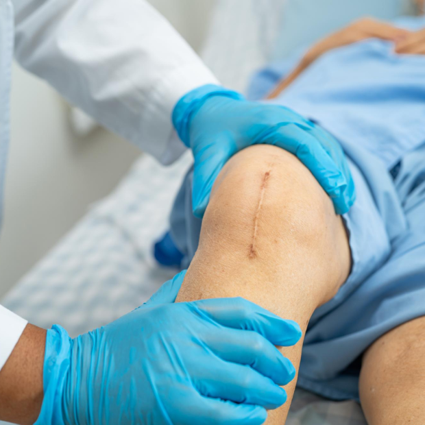 ACL Reconstruction