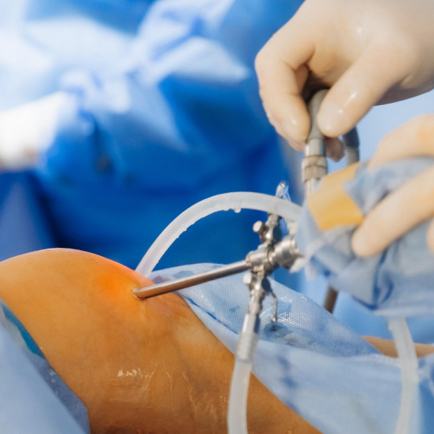 Arthroscopic Bankart’s repair treatment