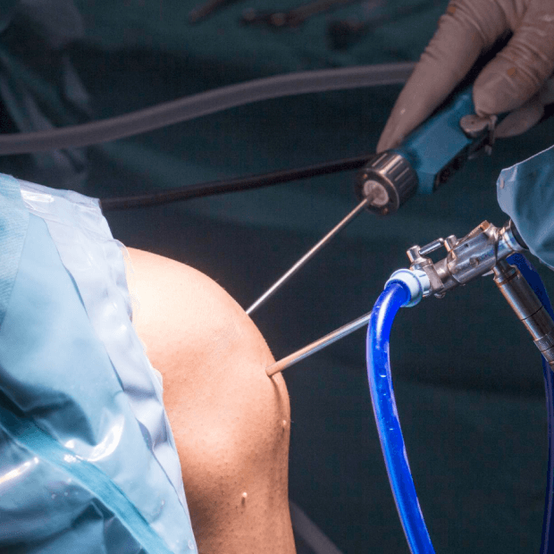 Arthroscopic Bankart’s Repair