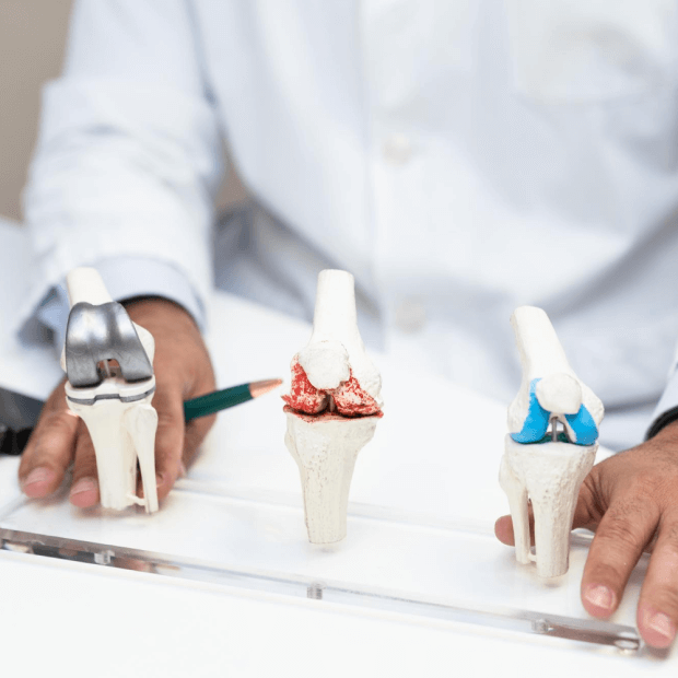 Cartilage Repair models