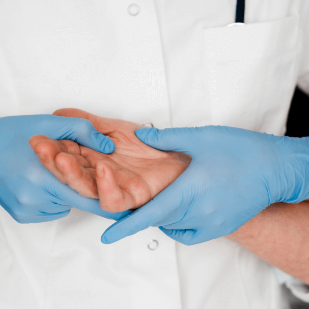 Endoscopic Carpal Tunnel Release