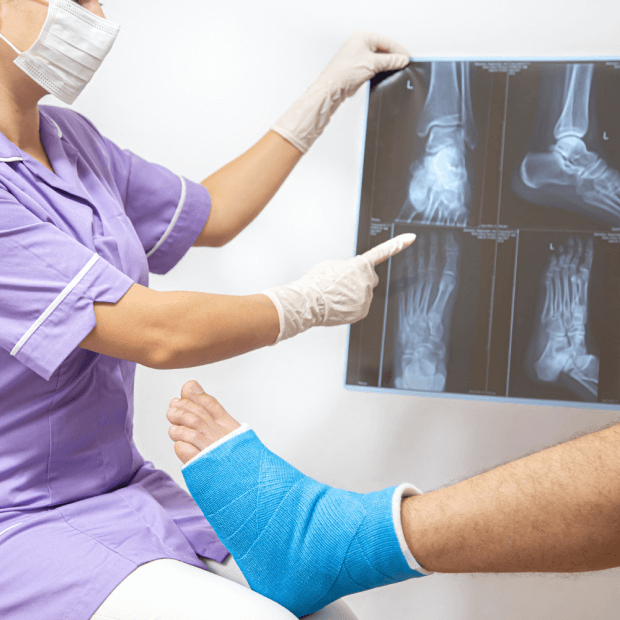 High Tibial Osteotomy with xray guidance