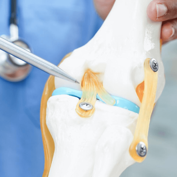 Meniscal transplantation