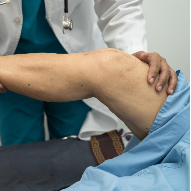 ACL Reconstruction Procedure