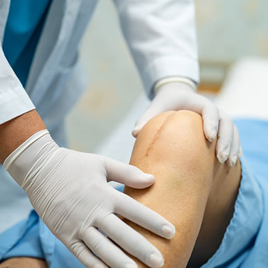 acl reconstruction
