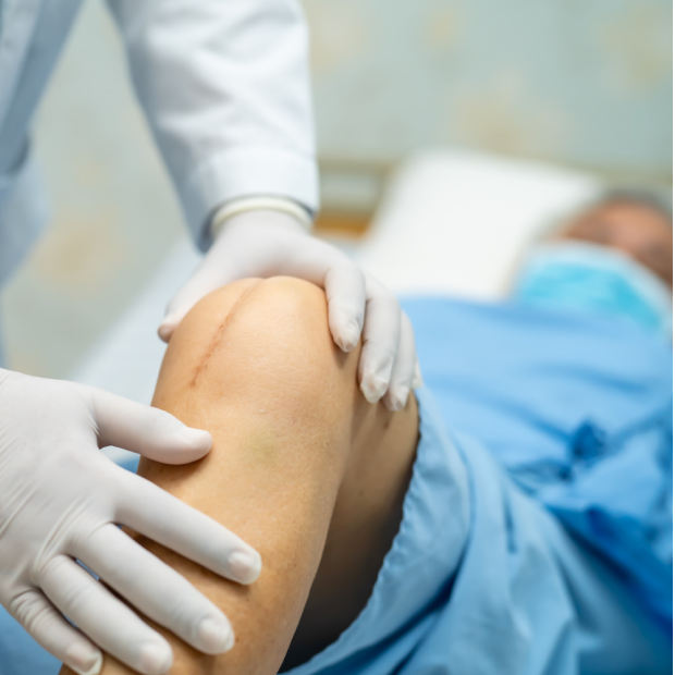 ACL Reconstruction