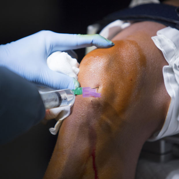 arthroscopic-rotator-cuff-treatment