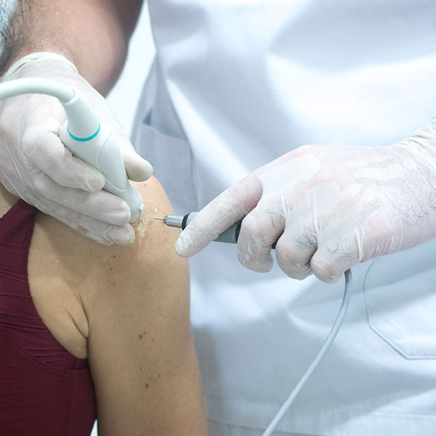 arthroscopic-rotator-cuff-repair-treatment