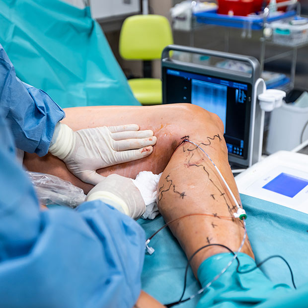 muscle slide surgery